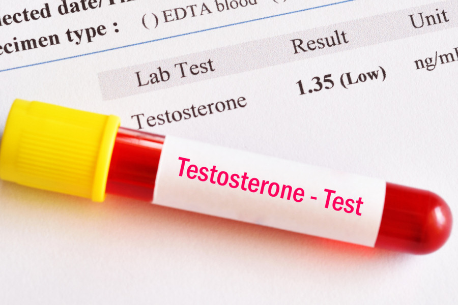 Testosterone libero