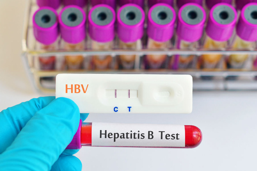 Epatite B (HBV)