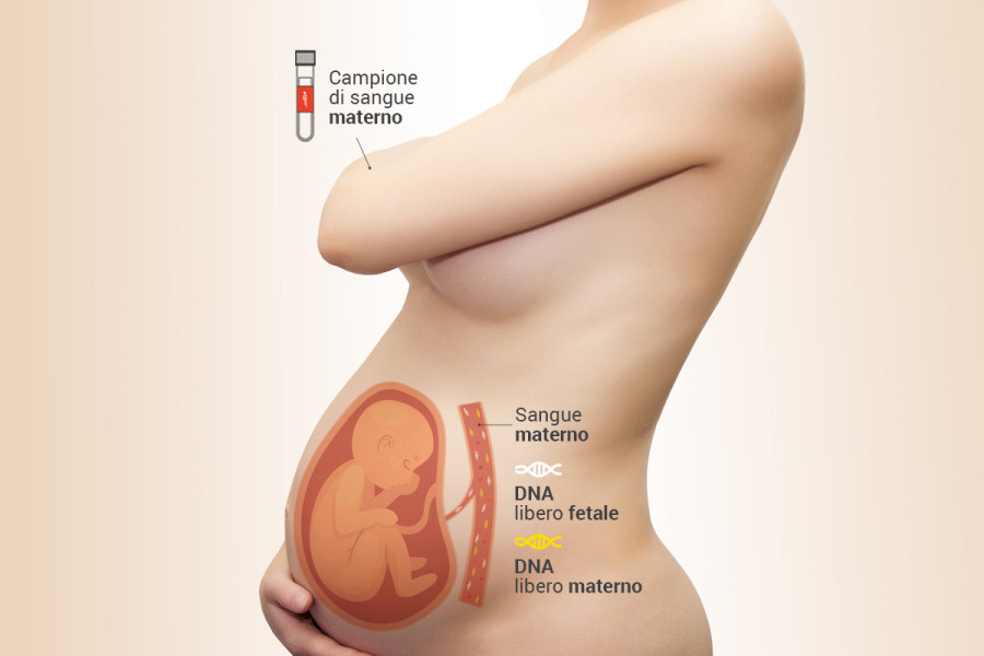 TEST SU DNA FETALE CIRCOLANTE